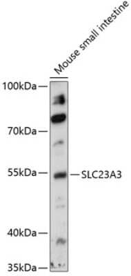 Western Blot: SLC23A3 AntibodyAzide and BSA Free [NBP2-95153]