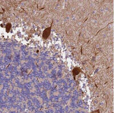 Immunohistochemistry-Paraffin: SLC24A3 Antibody [NBP2-30392]