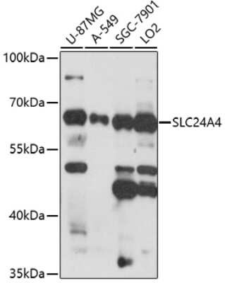 Western Blot: SLC24A4 AntibodyAzide and BSA Free [NBP2-93198]