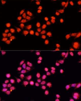 Immunocytochemistry/ Immunofluorescence: SLC24A5 Antibody - Azide and BSA Free [NBP3-04861]