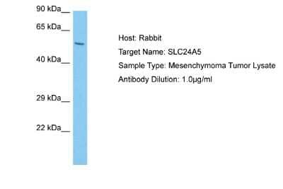 Western Blot: SLC24A5 Antibody [NBP2-84264]