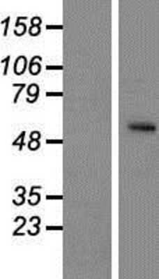 Western Blot: SLC24A5 Overexpression Lysate [NBP2-04531]