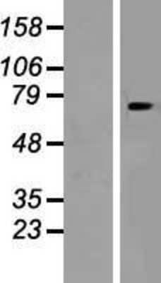 Western Blot: SLC24A6 Overexpression Lysate [NBP2-06255]