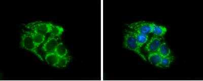 Immunocytochemistry/ Immunofluorescence: SLC25A1 Antibody [NBP1-31851]