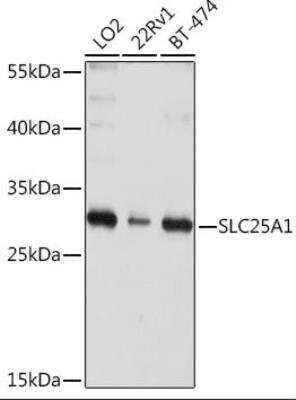 Western Blot: SLC25A1 AntibodyBSA Free [NBP2-93363]