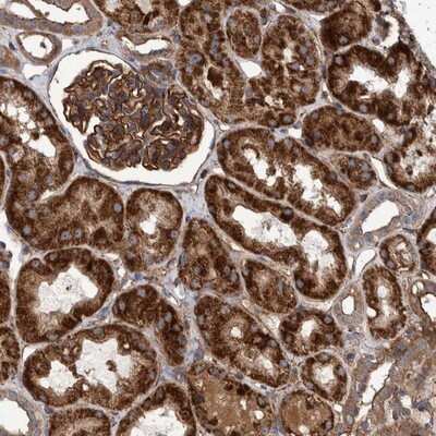 Immunohistochemistry-Paraffin: SLC25A10 Antibody [NBP1-85214]