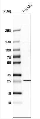 Western Blot: SLC25A10 Antibody [NBP1-85214]