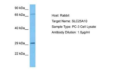 Western Blot: SLC25A10 Antibody [NBP2-83543]