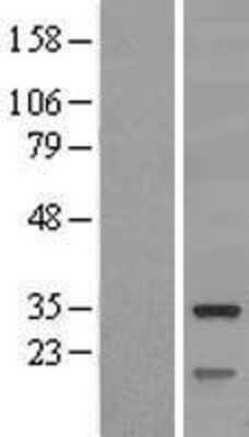 Western Blot: SLC25A10 Overexpression Lysate [NBL1-16046]