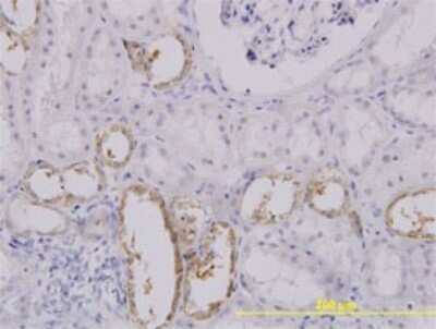 Immunohistochemistry-Paraffin: SLC25A11 Antibody (3G4) [H00008402-M01]