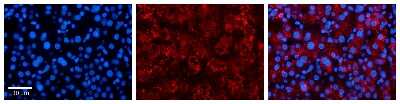Immunohistochemistry: SLC25A11 Antibody [NBP1-59597]