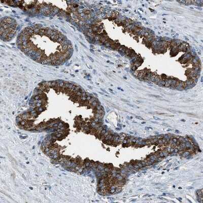 Immunohistochemistry-Paraffin: SLC25A11 Antibody [NBP1-82490]