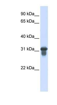 Western Blot: SLC25A11 Antibody [NBP1-59597]