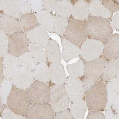 Immunohistochemistry-Paraffin: SLC25A12 Antibody [NBP1-89020]