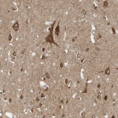 Immunohistochemistry-Paraffin: SLC25A12 Antibody [NBP1-89020]