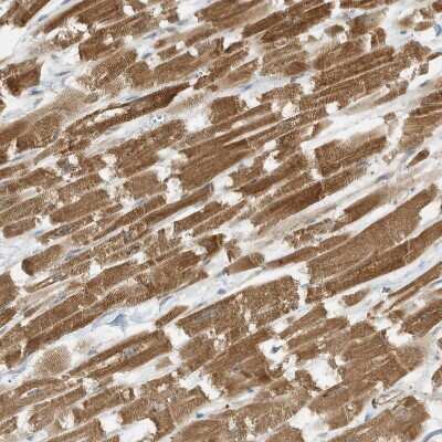 Immunohistochemistry-Paraffin: SLC25A12 Antibody [NBP1-89020]
