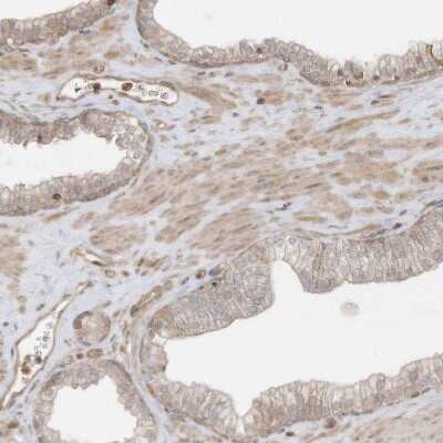Immunohistochemistry-Paraffin: SLC25A12 Antibody [NBP1-89020]