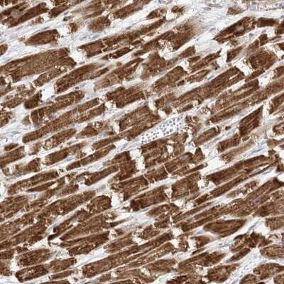 Immunohistochemistry-Paraffin: SLC25A12 Antibody [NBP2-38249]