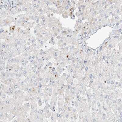 Immunohistochemistry-Paraffin: SLC25A12 Antibody [NBP2-38249]