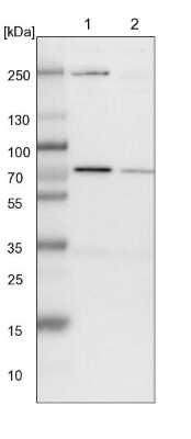 Western Blot: SLC25A12 Antibody [NBP1-89020]