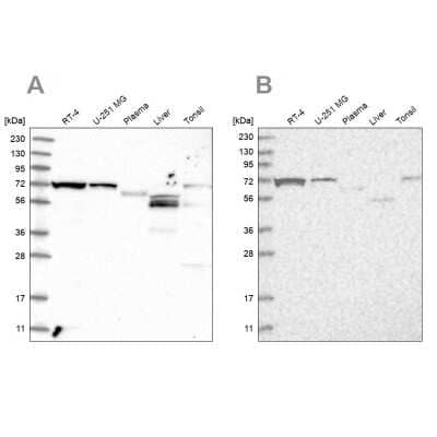 Western Blot: SLC25A12 Antibody [NBP1-89020]