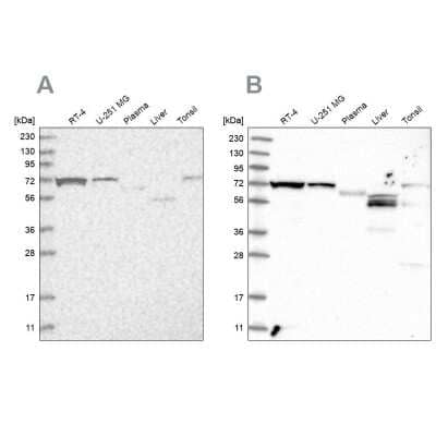 Western Blot: SLC25A12 Antibody [NBP2-38249]