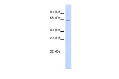 Western Blot: SLC25A12 Antibody [NBP2-88288]