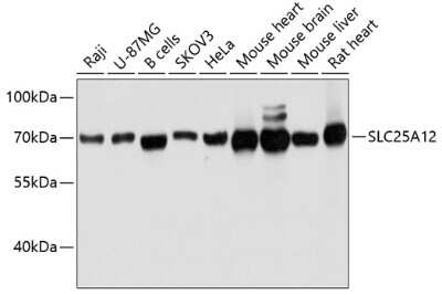 Western Blot: SLC25A12 AntibodyAzide and BSA Free [NBP2-93669]