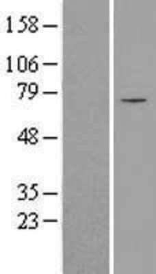 Western Blot: SLC25A12 Overexpression Lysate [NBL1-16048]