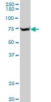 Western Blot: SLC25A13 Antibody (4F4) [H00010165-M01]