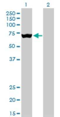 Western Blot: SLC25A13 Antibody (4F4) [H00010165-M01]