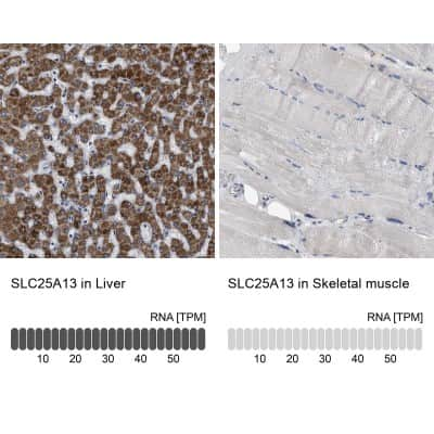 Immunohistochemistry-Paraffin: SLC25A13 Antibody [NBP1-89019]