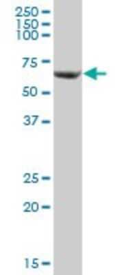 Western Blot: SLC25A13 Antibody [H00010165-B01P]