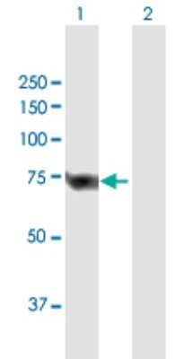 Western Blot: SLC25A13 Antibody [H00010165-B01P]