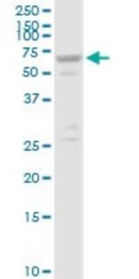Western Blot: SLC25A13 Antibody [H00010165-D01P]