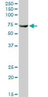 Western Blot: SLC25A13 Antibody [H00010165-D01P]