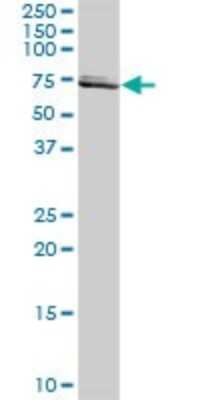 Western Blot: SLC25A13 Antibody [H00010165-D01P]