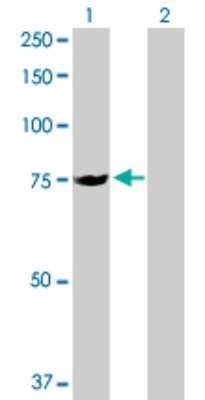 Western Blot: SLC25A13 Antibody [H00010165-D01P]
