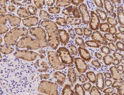 Immunohistochemistry-Paraffin: SLC25A15 Antibody [NBP3-12684]