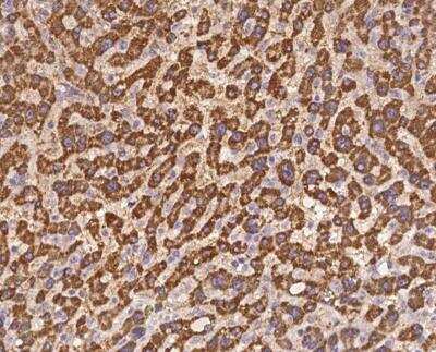 Immunohistochemistry-Paraffin: SLC25A15 Antibody [NBP3-12684]