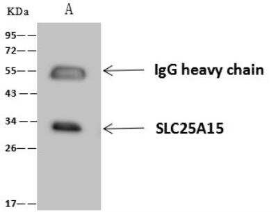Immunoprecipitation: SLC25A15 Antibody [NBP3-12684]