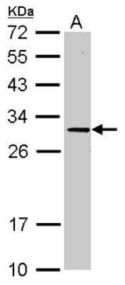 Western Blot: SLC25A15 Antibody [NBP2-20387]