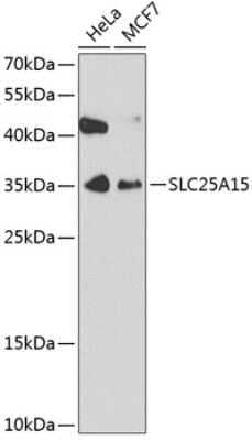 Western Blot: SLC25A15 AntibodyBSA Free [NBP2-94891]