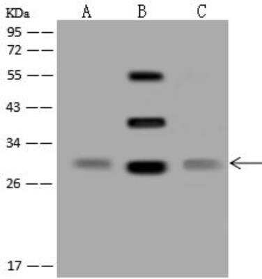 Western Blot: SLC25A15 Antibody [NBP3-12684]