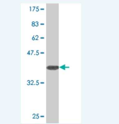 Western Blot: SLC25A18 Antibody (2F12) [H00083733-M02]