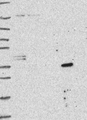 Western Blot: SLC25A18 Antibody [NBP3-17540]