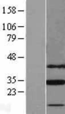 Western Blot: SLC25A18 Overexpression Lysate [NBL1-16053]