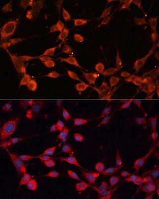 Immunocytochemistry/ Immunofluorescence: SLC25A19 Antibody - Azide and BSA Free [NBP2-94007]