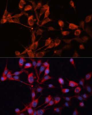 Immunocytochemistry/ Immunofluorescence: SLC25A19 Antibody - Azide and BSA Free [NBP3-04795]