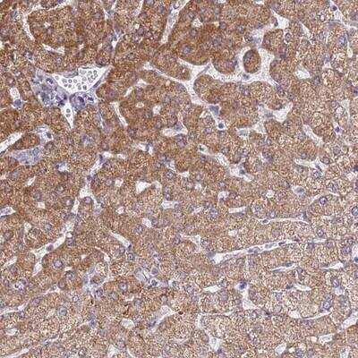 Immunohistochemistry: SLC25A15 Antibody [NBP2-13320]